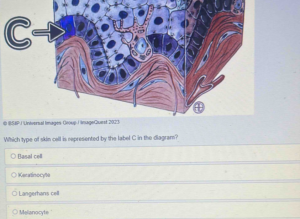 Solved: Which type of skin cell is represented by the label C in the ...