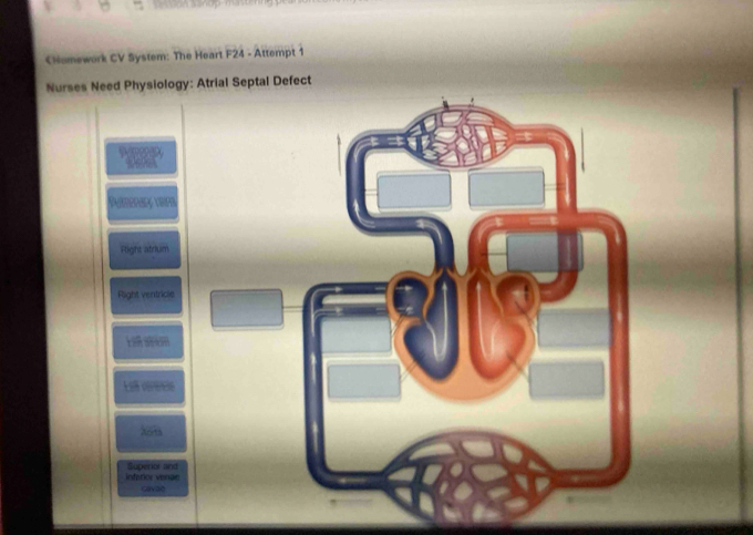 CHomework CV System: The Heart F24 - Attempt 1
Nurses Need Physiology: Atrial Septal Defect
Right atrium
Right ventricle
nfários vera= Superior and
cavae