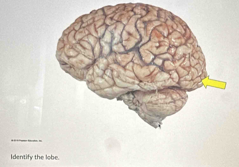 Identify the lobe.