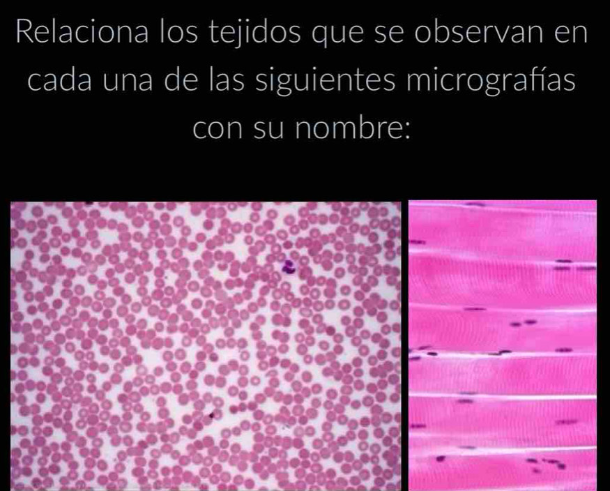 Relaciona los tejidos que se observan en 
cada una de las siguientes micrografías 
con su nombre: