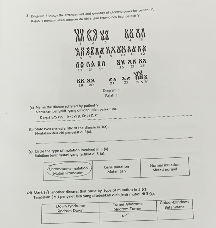 Diagram 3 shows the arrangement and quantity of chromosomes for patient Y, 
Rajah 3 menunjukkan susunan da nbilangan kromosom bagi pesakit Y.
4 5
1 2 3
6 7 8 9 10 11 12
X
13 14 15 16 17 18
K K
19 20 21 22 XXY
Diagram 3 
Rajah 3 
(a) Name the disease suffered by patlent Y. 
_ 
Namakan penyakit yang dihidapi oleh pesakit itu. 
(b) State two characteristic of the disease in 3(a). 
_ 
Nyatakan dua ciri penyakit di 3(a). 
(c) Circle the type of mutation Involved in 3 (a). 
jenis mutasi yang terlibat di 3 (a). 
(d) Mark (√) another diseases that cause by type of mutation in 3 (c). 
( √ ) penyakit lain yang disebabkan oleh jenis mutasi di 3 (c).