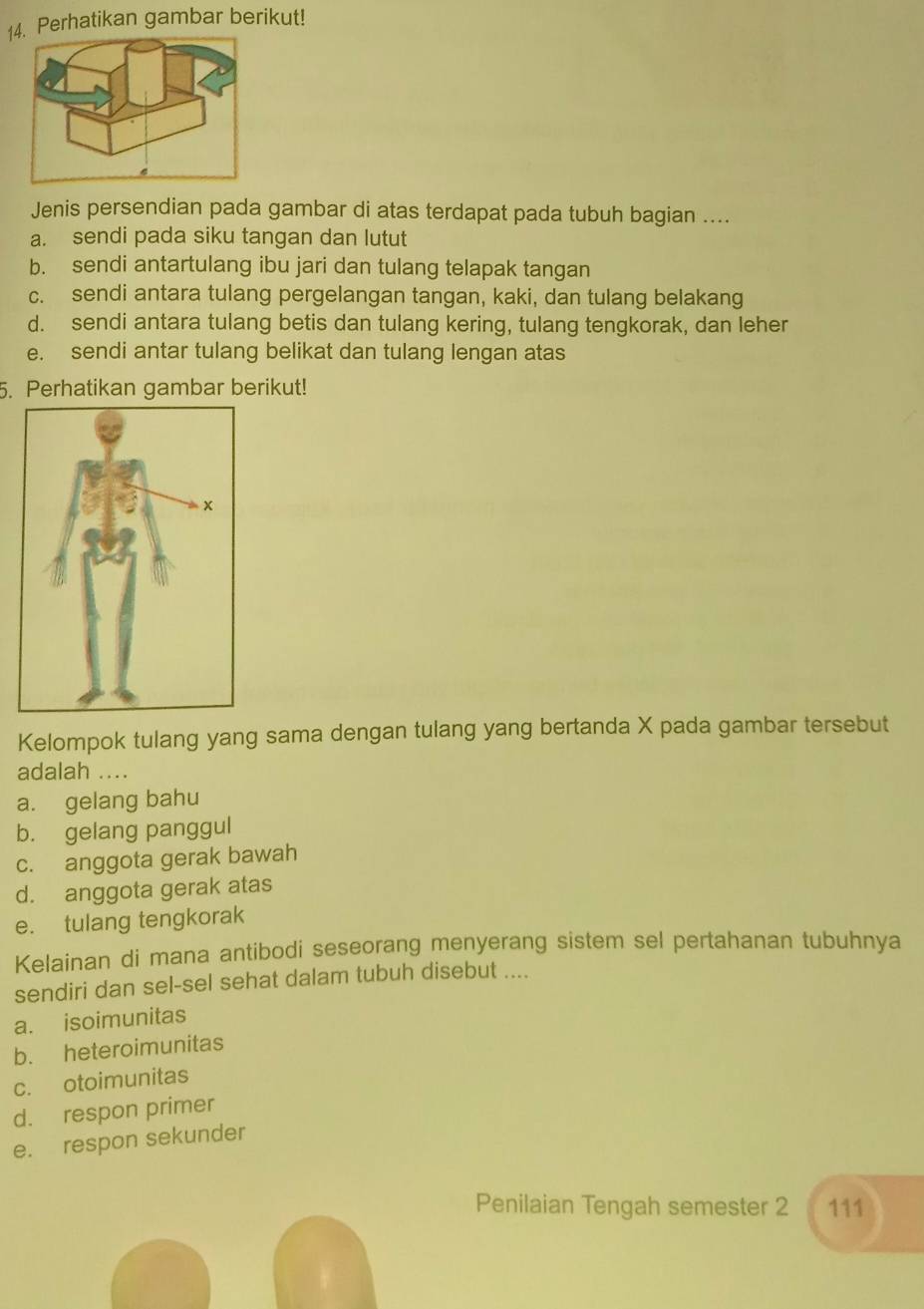 Perhatikan gambar berikut!
Jenis persendian pada gambar di atas terdapat pada tubuh bagian ....
a. sendi pada siku tangan dan lutut
b. sendi antartulang ibu jari dan tulang telapak tangan
c. sendi antara tulang pergelangan tangan, kaki, dan tulang belakang
d. sendi antara tulang betis dan tulang kering, tulang tengkorak, dan leher
e. sendi antar tulang belikat dan tulang lengan atas
5. Perhatikan gambar berikut!
Kelompok tulang yang sama dengan tulang yang bertanda X pada gambar tersebut
adalah ....
a. gelang bahu
b. gelang panggul
c. anggota gerak bawah
d. anggota gerak atas
e. tulang tengkorak
Kelainan di mana antibodi seseorang menyerang sistem sel pertahanan tubuhnya
sendiri dan sel-sel sehat dalam tubuh disebut ....
a. isoimunitas
b. heteroimunitas
c. otoimunitas
d. respon primer
e. respon sekunder
Penilaian Tengah semester 2 111