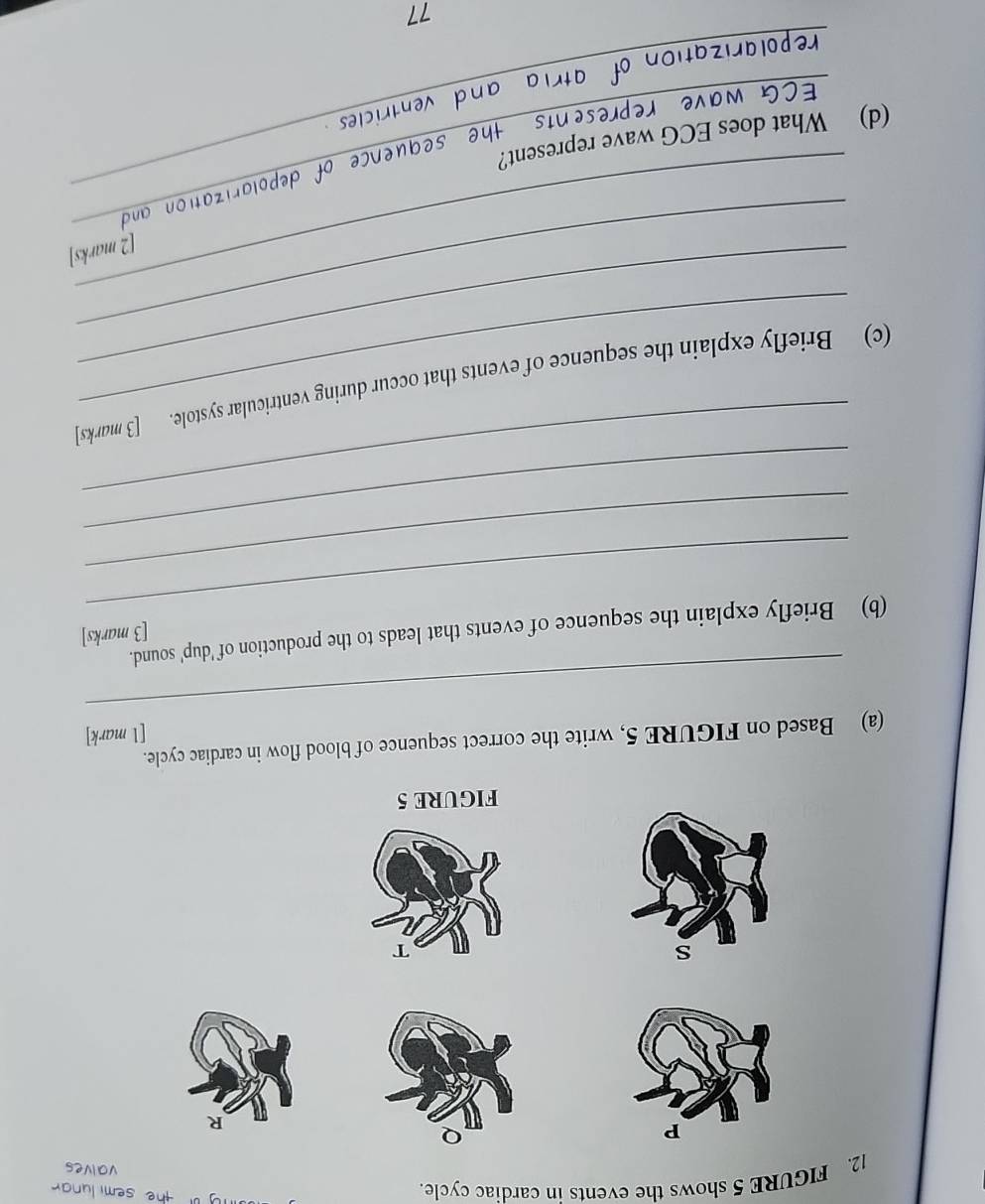 FIGURE 5 shows the events in cardiac cycle.
y o the semi lunar . 
valves
P
R 
s 
FIGURE 5 
(a) Based on FIGURE 5, write the correct sequence of blood flow in cardiac cycle. 
[l mark] 
_ 
[3 marks] 
_ 
(b) Briefly explain the sequence of events that leads to the production of 'dup' sound. 
_ 
_ 
_ 
_ 
_ 
(c) Briefly explain the sequence of events that occur during ventricular systole. [3 marks] 
_ 
[2 marks] 
(d) What does ECG wave represent? ence of depolarization and 
epre 
z 
77