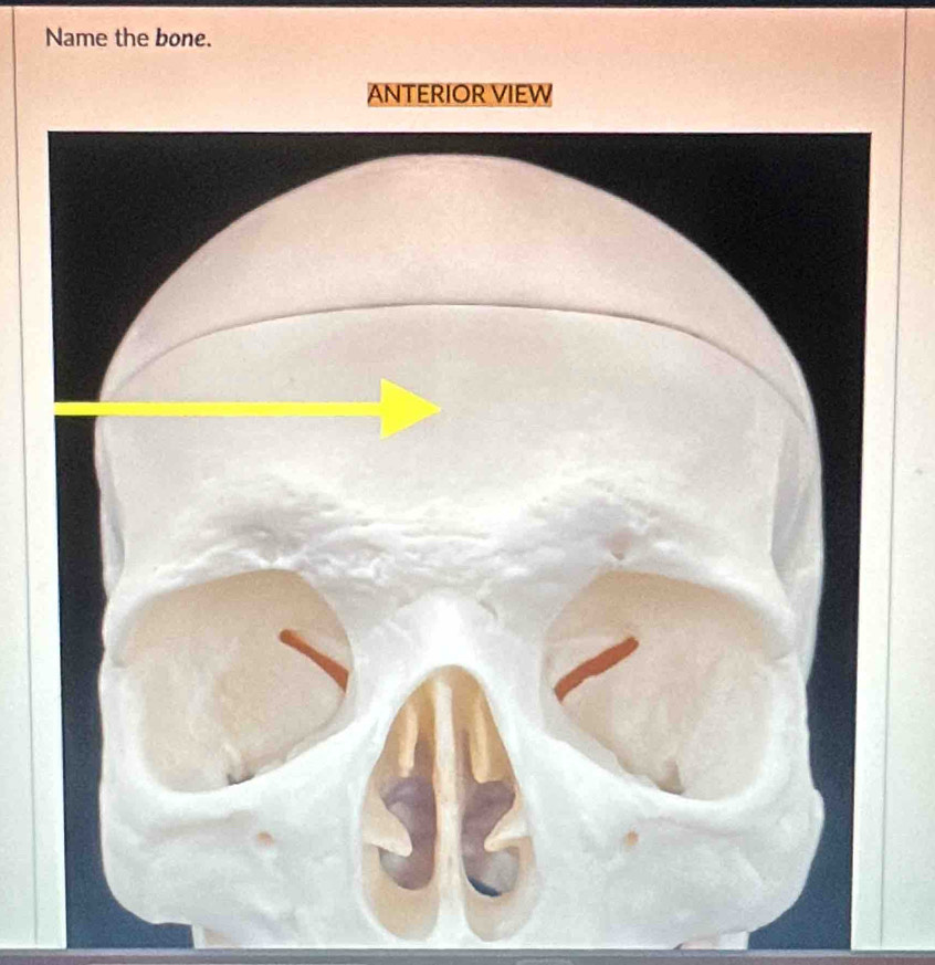 Name the bone. 
ANTERIOR VIEW