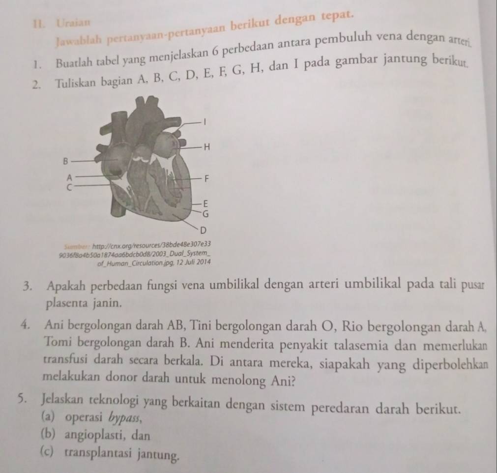 Uraian 
Jawablah pertanyaan-pertanyaan berikut dengan tepat. 
1. Buatlah tabel yang menjelaskan 6 perbedaan antara pembuluh vena dengan arter. 
2. Tuliskan bagian A, B, C, D, E, F, G, H, dan I pada gambar jantung berikut 
Sumber: http://cnx.org/resources/38bde48e307e33 
9036f8a4b50a1874aa6bdcb0d8/2003_Dual_System_ 
of_Human_Circulation.jpg. 12 Juli 2014 
3. Apakah perbedaan fungsi vena umbilikal dengan arteri umbilikal pada tali pusar 
plasenta janin. 
4. Ani bergolongan darah AB, Tini bergolongan darah O, Rio bergolongan darah A, 
Tomi bergolongan darah B. Ani menderita penyakit talasemia dan memerlukan 
transfusi darah secara berkala. Di antara mereka, siapakah yang diperbolehkan 
melakukan donor darah untuk menolong Ani? 
5. Jelaskan teknologi yang berkaitan dengan sistem peredaran darah berikut. 
(a) operasi bypass, 
(b) angioplasti, dan 
(c) transplantasi jantung.