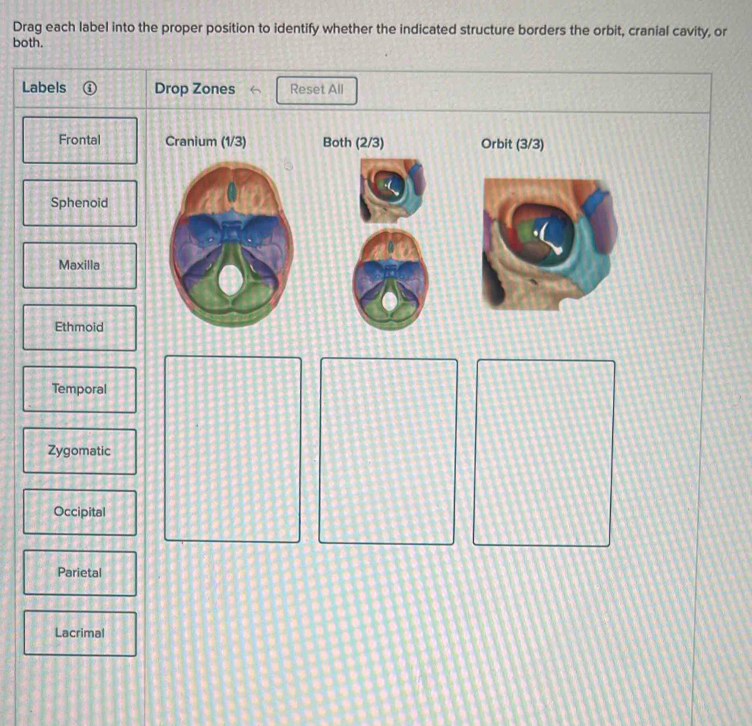 Solved: Drag each label into the proper position to identify whether ...