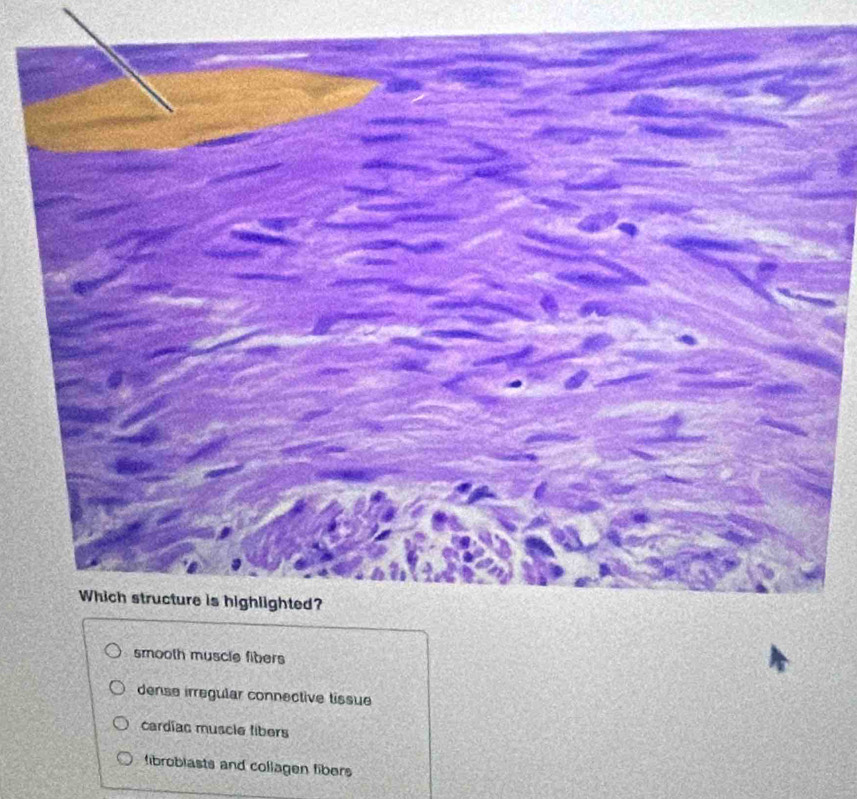 smooth muscle fibers
dense irregular connective tissue
cardíac muscle libers
fibroblasts and collagen fibers