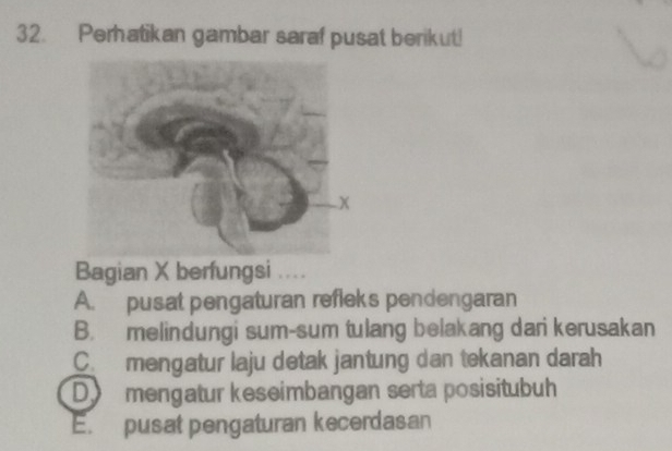 Perhatikan gambar saraf pusat berikut!
Bagian X berfungsi ....
A. pusat pengaturan refleks pendengaran
B. melindungi sum-sum tulang belakang dari kerusakan
C. mengatur laju detak jantung dan tekanan darah
Do mengatur keseimbangan serta posisitubuh
E. pusat pengaturan kecerdasan