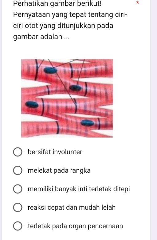 Perhatikan gambar berikut!
*
Pernyataan yang tepat tentang ciri-
ciri otot yang ditunjukkan pada
gambar adalah ...
bersifat involunter
melekat pada rangka
memiliki banyak inti terletak ditepi
reaksi cepat dan mudah lelah
terletak pada organ pencernaan