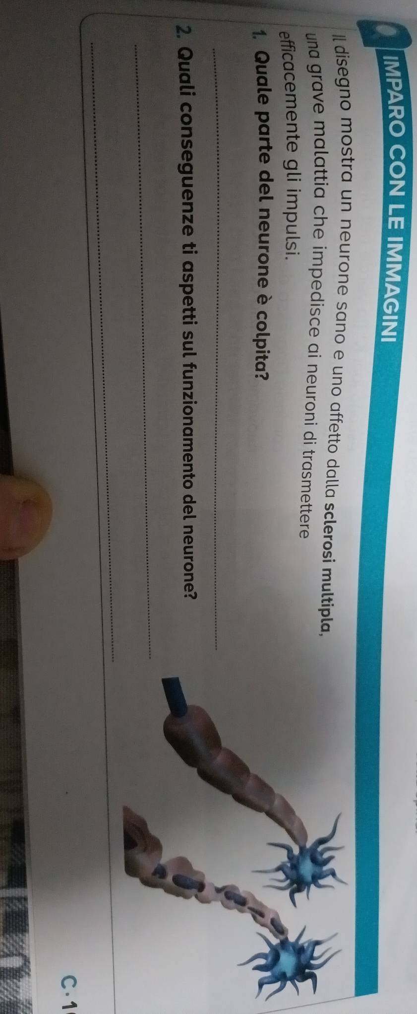 IMPARO CON LE IMMAGINI 
Il disegno mostra un neurone sano e uno affetto dalla sclerosi multipla, 
una grave malattia che impedisce ai neuroni di trasmettere. 
efficacemente gli impulsi. 
1. Quale parte del neurone è colpita? 
_ 
2. Quali conseguenze ti aspetti sul funzionamento del neurone? 
_ 
_ 
C. 1