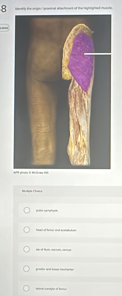 ldentify the origin / proximal attachment of the highlighted muscle.
2.29:§2
Multiple Choice
pubic symphysis
head of femur and acetabulum
ala of ilium, sacrum, coccyx
greater and lesser trochanter
lateral condyle of femur