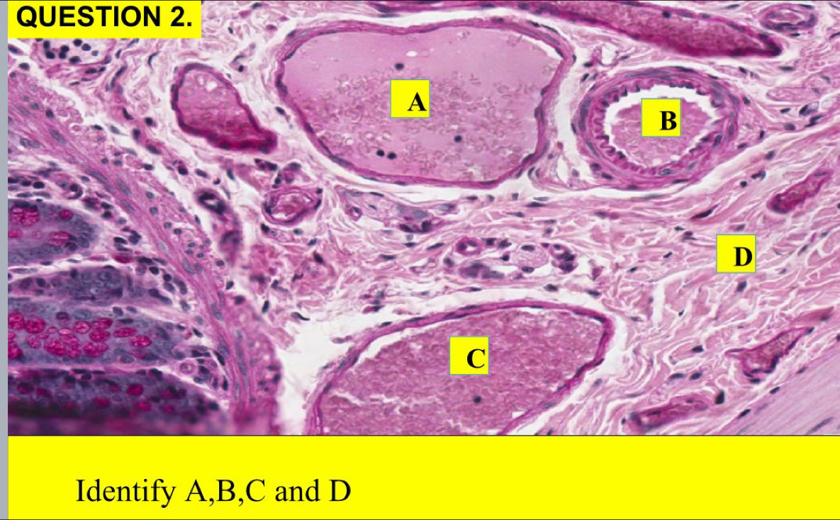 A 
B 
D
C
Identify A, B, C and D