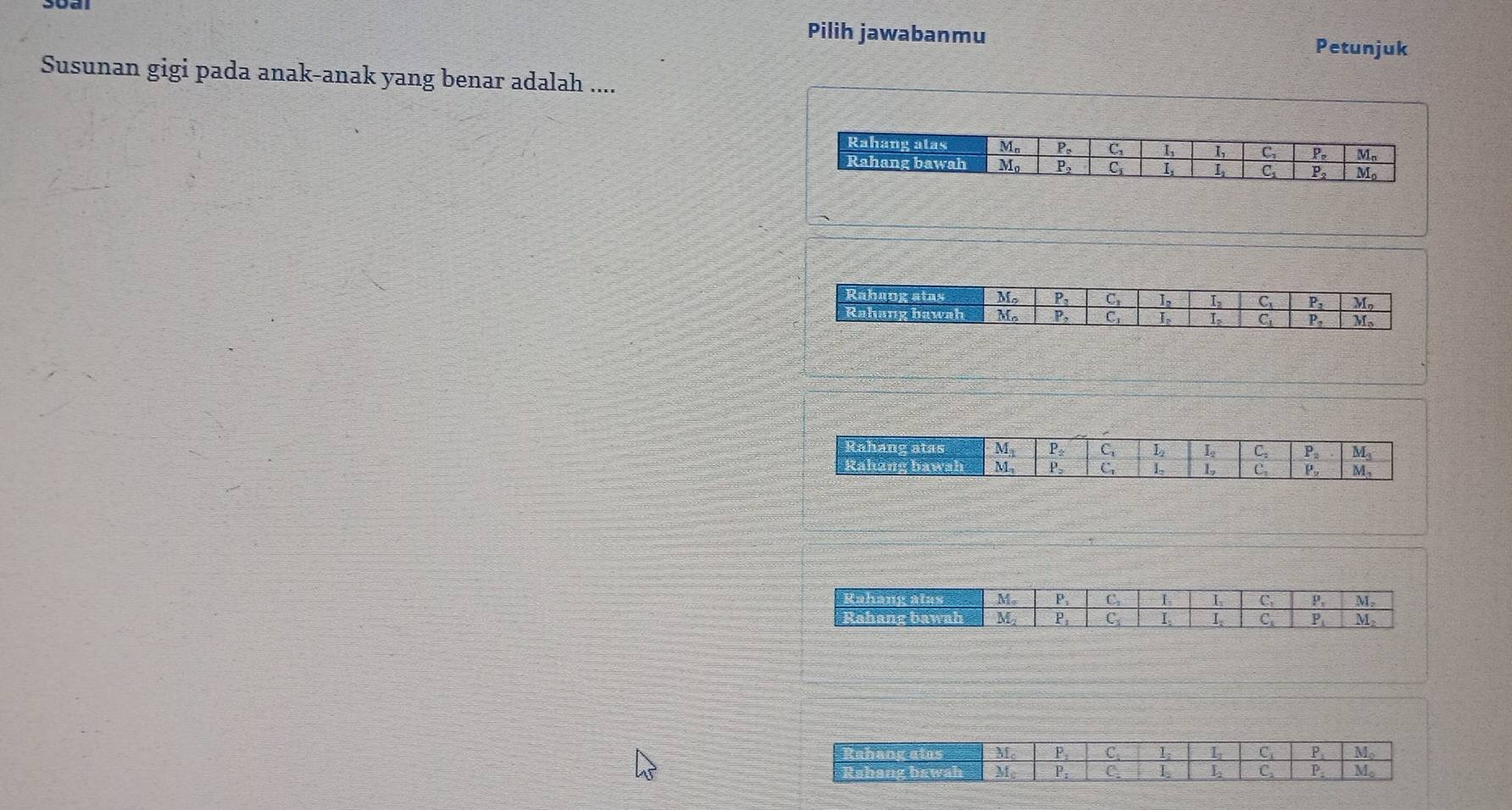 Pilih jawabanmu Petunjuk
Susunan gigi pada anak-anak yang benar adalah ....