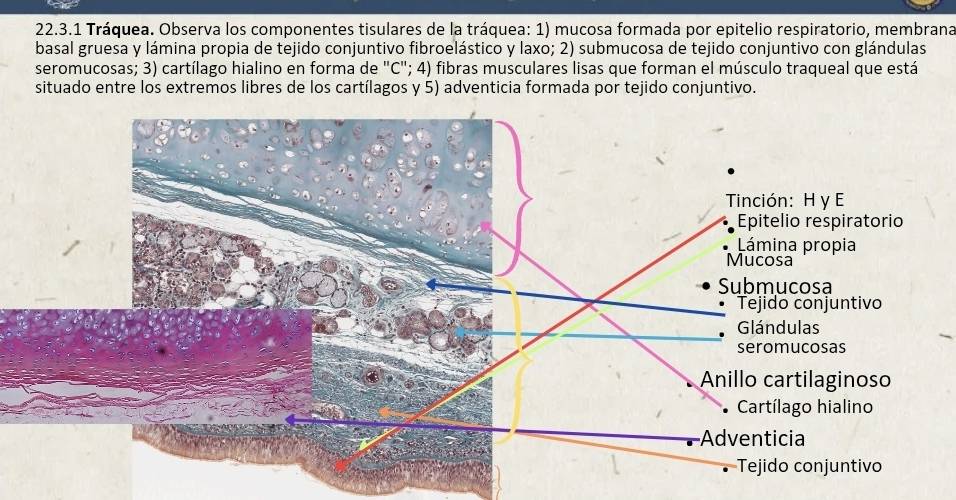 Tráquea. Observa los componentes tisulares de la tráquea: 1) mucosa formada por epitelio respiratorio, membrana 
basal gruesa y lámina propia de tejido conjuntivo fibroelástico y laxo; 2) submucosa de tejido conjuntivo con glándulas 
seromucosas; 3) cartílago hialino en forma de "C"; 4) fibras musculares lisas que forman el músculo traqueal que está 
situado entre los extremos libres de los cartílagos y 5) adventicia formada por tejido conjuntivo.