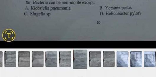 86- Bacteria can be non-motile except:
A. Klebsiella pneumonia B. Yersinia pestis
C. Shigella sp D. Helicobacter pylori
10
T