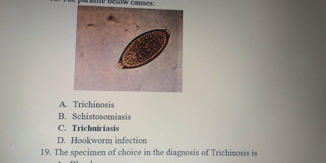 parasne bélow causes:
A. Trichinosis
B. Schistosomiasis
C. Trichuiriasis
D. Hookworm infection
19. The specimen of choice in the diagnosis of Trichinosis is