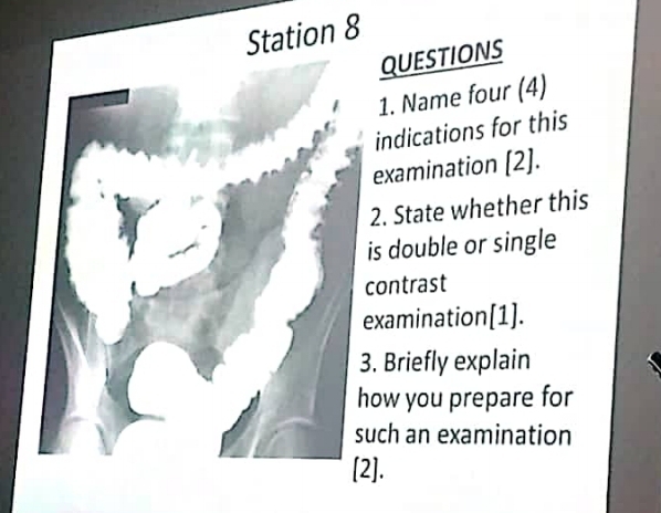 Station 8 
QUESTIONS 
1. Name four (4) 
indications for this 
examination [2]. 
2. State whether this 
is double or single 
contrast 
examination[1]. 
3. Briefly explain 
how you prepare for 
such an examination 
[2].