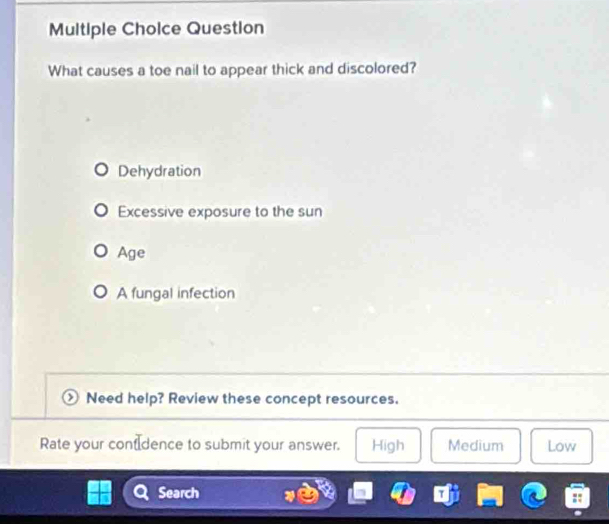 Question
What causes a toe nail to appear thick and discolored?
Dehydration
Excessive exposure to the sun
Age
A fungal infection
Need help? Review these concept resources.
Rate your cont dence to submit your answer. High Medium Low
Search