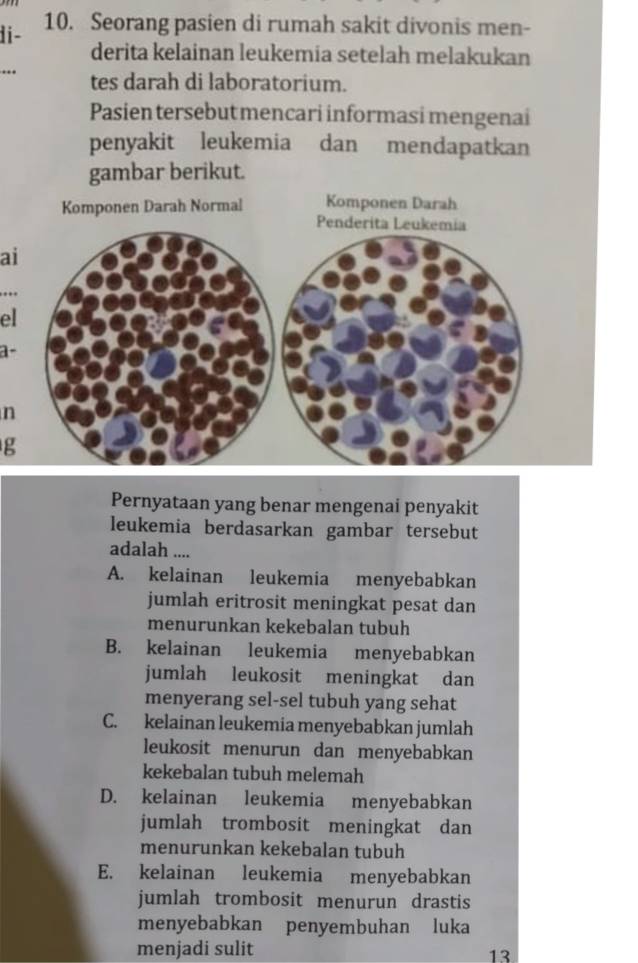 1i- 10. Seorang pasien di rumah sakit divonis men-
derita kelainan leukemia setelah melakukan
..
tes darah di laboratorium.
Pasien tersebut mencari informasi mengenai
penyakit leukemia dan mendapatkan
gambar berikut.
ai
el
a-
n
g
Pernyataan yang benar mengenai penyakit
leukemia berdasarkan gambar tersebut
adalah ....
A. kelainan leukemia menyebabkan
jumlah eritrosit meningkat pesat dan
menurunkan kekebalan tubuh
B. kelainan leukemia menyebabkan
jumlah leukosit meningkat dan
menyerang sel-sel tubuh yang sehat
C. kelainan leukemia menyebabkan jumlah
leukosit menurun dan menyebabkan
kekebalan tubuh melemah
D. kelainan leukemia menyebabkan
jumlah trombosit meningkat dan
menurunkan kekebalan tubuh
E. kelainan leukemia menyebabkan
jumlah trombosit menurun drastis
menyebabkan penyembuhan luka
menjadi sulit
13