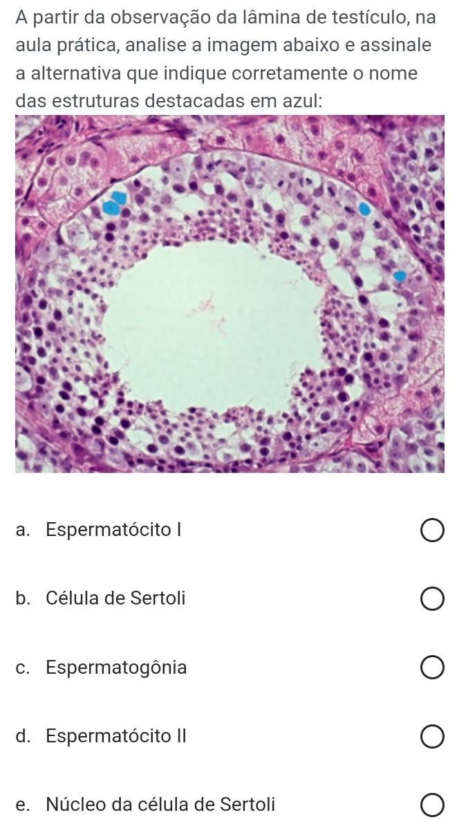 A partir da observação da lâmina de testículo, na
aula prática, analise a imagem abaixo e assinale
a alternativa que indique corretamente o nome
das estruturas destacadas em azul:
a. Espermatócito I
b. Célula de Sertoli
c. Espermatogônia
d. Espermatócito II
e. Núcleo da célula de Sertoli