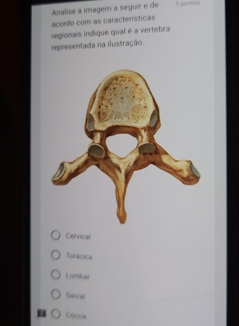 Analise a imagem a seguir e de 5 pontos
acordo com as características
regionais indique qual é a vertebra
representada na ilustração.
Cervical
Torácica
Lombar
Sacral
Cáccix