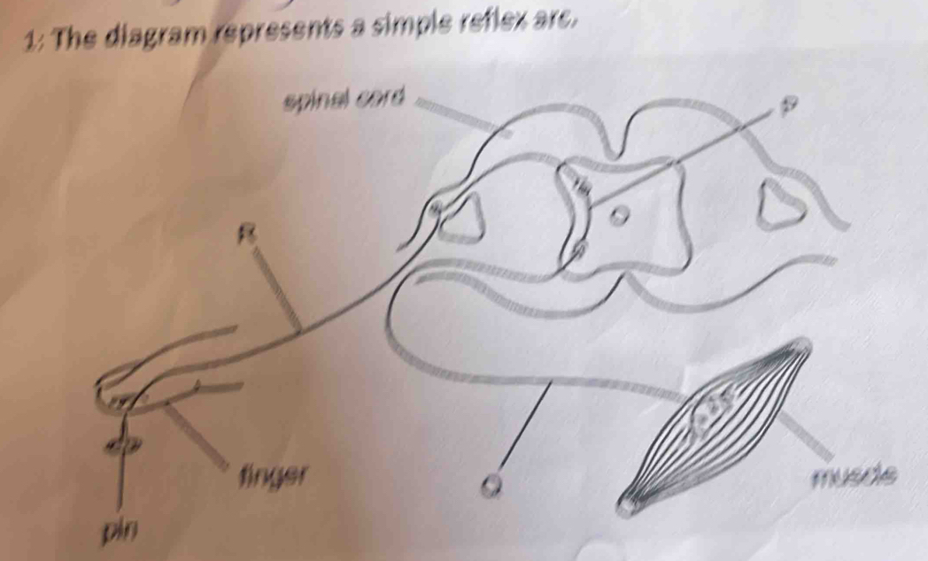 1: The diagram represents a simple reflex are.