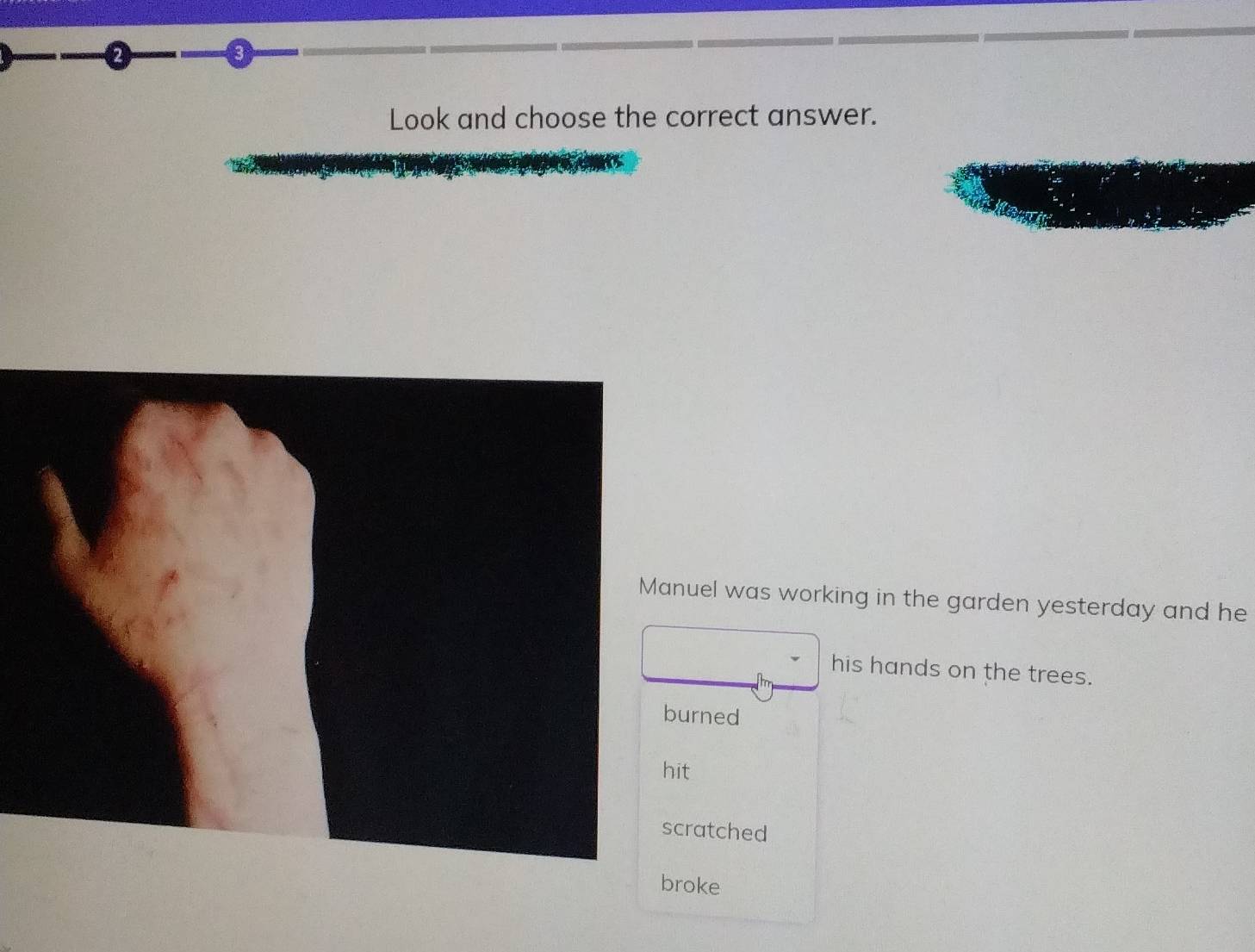 Look and choose the correct answer.
uel was working in the garden yesterday and he
his hands on the trees.
urned
it
ratched
broke