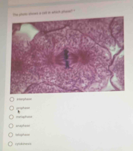 The sheito shows a call an which ahene? "
interphase
prophase
metaphase
anaphase
telophase
cytokinesis