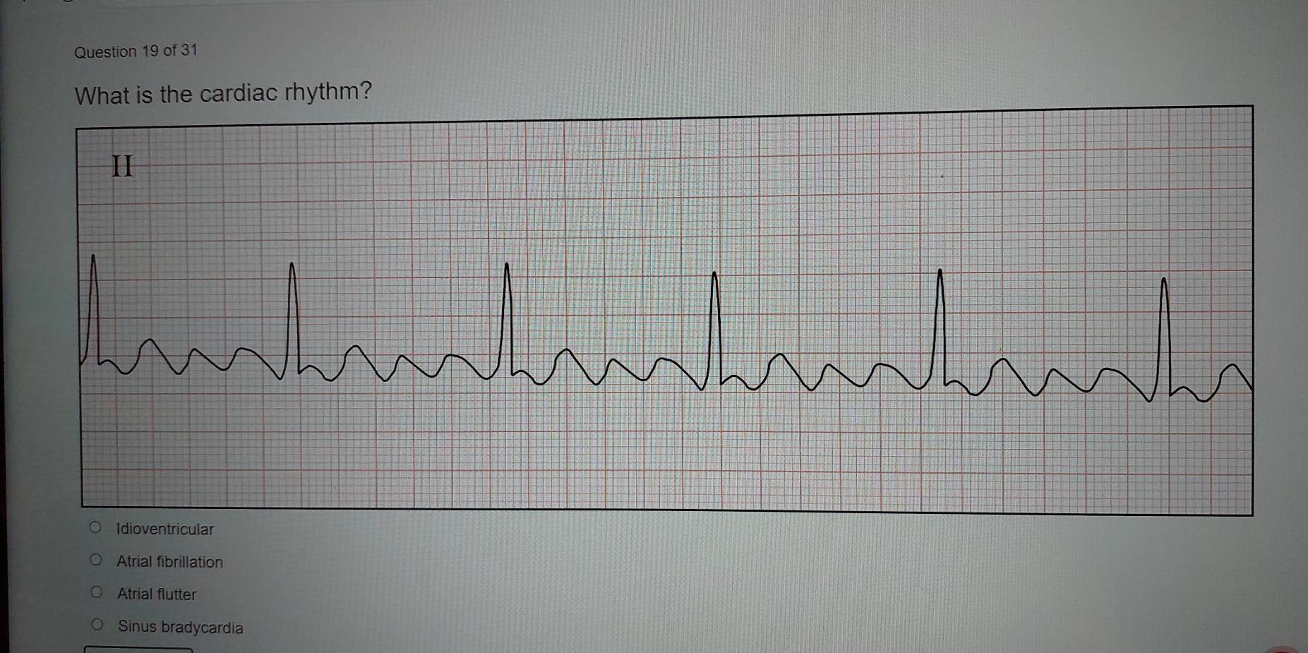 What is the cardiac rhythm?
II
Idioventricular
Atrial fibrillation
Atrial flutter
Sinus bradycardia