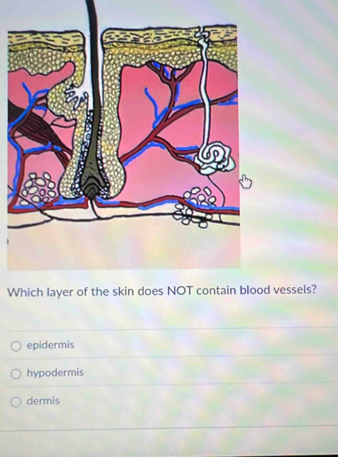 Wd vessels?
epidermis
hypodermis
dermis