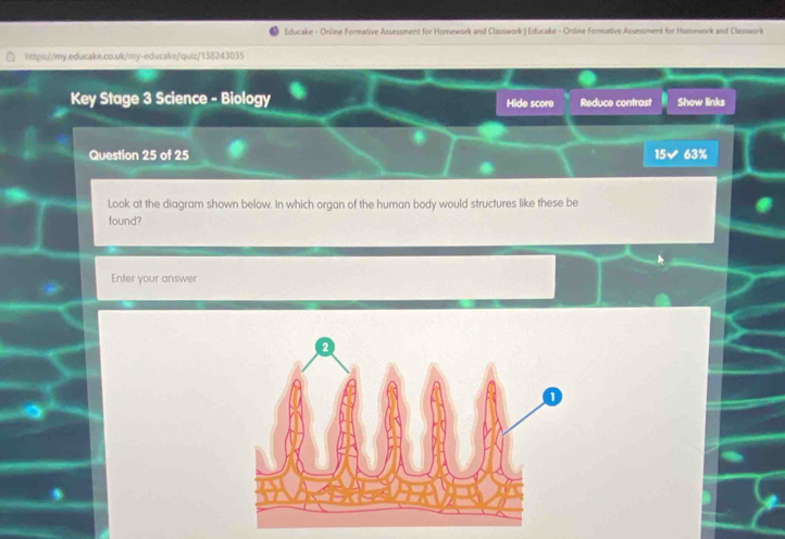 Educake - Online Formative Assessment for Homework and Classwork | Educake - Online Formative Assessment for Homework and Classwork 
https://my.educake.co.uk/my-educake/quiz/138243035 
Key Stage 3 Science - Biology Hide score Reduce contrast Show links 
Question 25 of 25 15✔ 63%
Look at the diagram shown below. In which organ of the human body would structures like these be 
found? 
Enter your answer