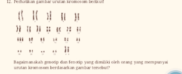 Perhatikan gambar urutan kromosom berikut!
x 1 8 5
H " 
Bagaimanakah genotip dan fenotip yang dimiliki oleh orang yang mempunyai 
urutan kromosom berdasarkan gambar tersebut?