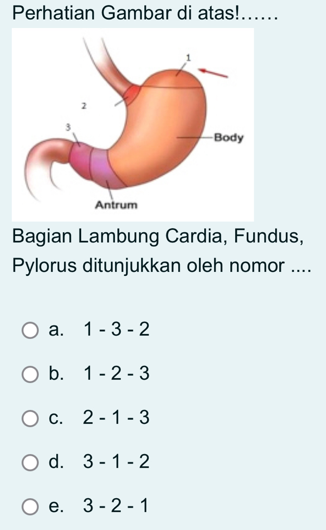 Perhatian Gambar di atas!......
Bagian Lambung Cardia, Fundus,
Pylorus ditunjukkan oleh nomor ....
a. 1-3-2
b. 1-2-3
C. 2-1-3
d. 3-1-2
e. 3-2-1