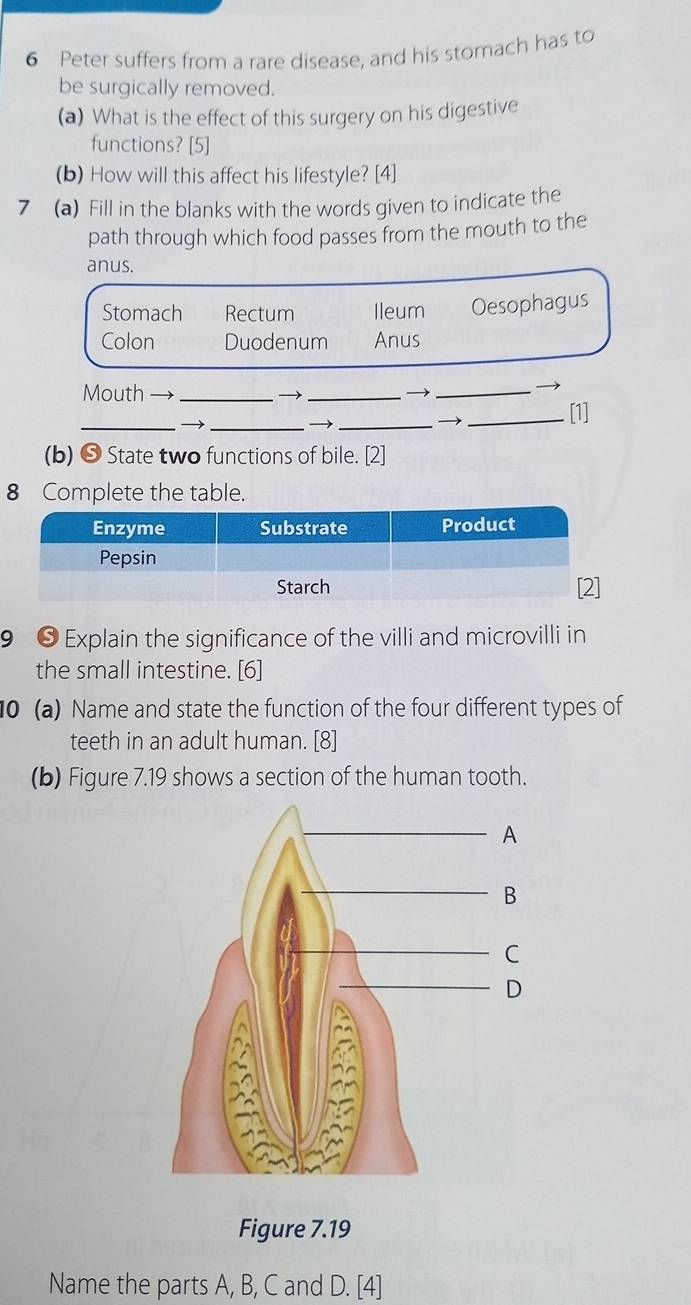 Peter suffers from a rare disease, and his stomach has to
be surgically removed.
(a) What is the effect of this surgery on his digestive
functions? [5]
(b) How will this affect his lifestyle? [4]
7 (a) Fill in the blanks with the words given to indicate the
path through which food passes from the mouth to the
anus.
Stomach Rectum Ileum Oesophagus
Colon Duodenum Anus
Mouth → __→_
→
__
_→
_[1]
(b) ❺ State two functions of bile. [2]
8 Complete the table.
9 ● Explain the significance of the villi and microvilli in
the small intestine. [6]
10 (a) Name and state the function of the four different types of
teeth in an adult human. [8]
(b) Figure 7.19 shows a section of the human tooth.
Figure 7.19
Name the parts A, B, C and D. [4]