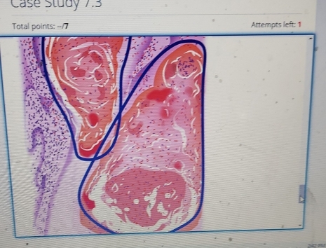 Case Study 7.3
Total points: --/7 Attempts left: 1