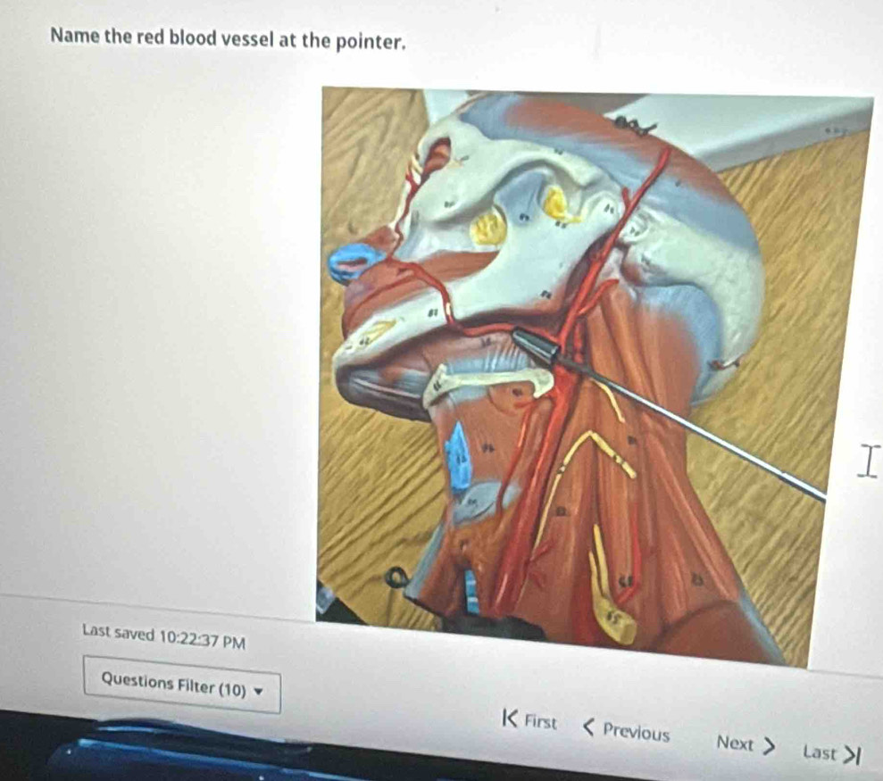 Name the red blood vessel at the pointer. 
I 
Last saved 10:22:37 PM 
Questions Filter (10) KFirst Previous Next 
Last >