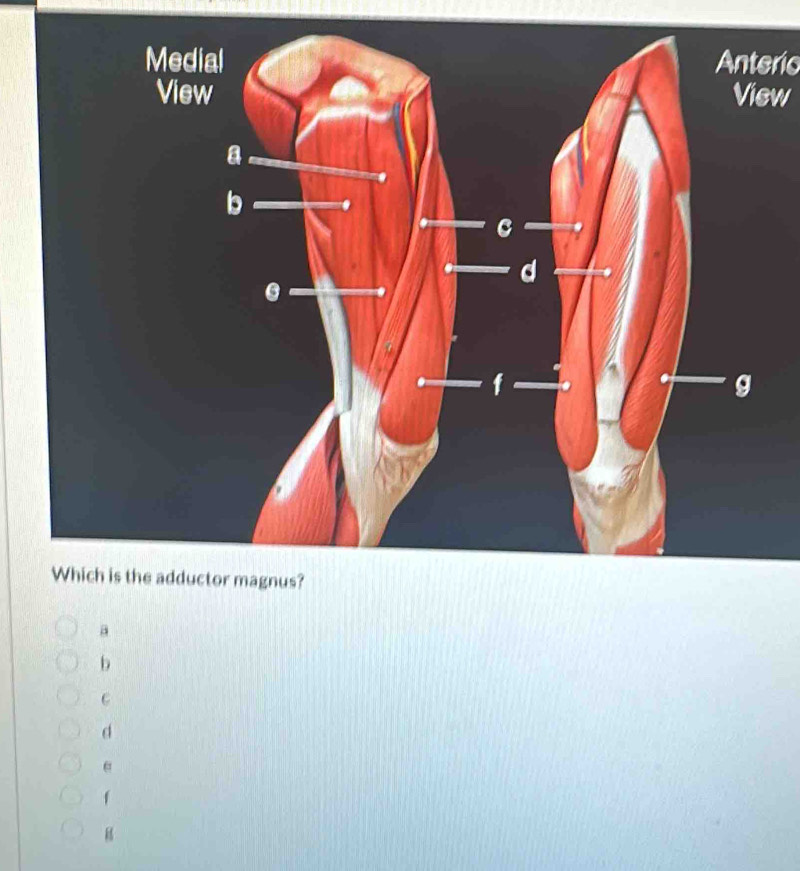 Anterio 
View
a
b
C
d
e
f
B