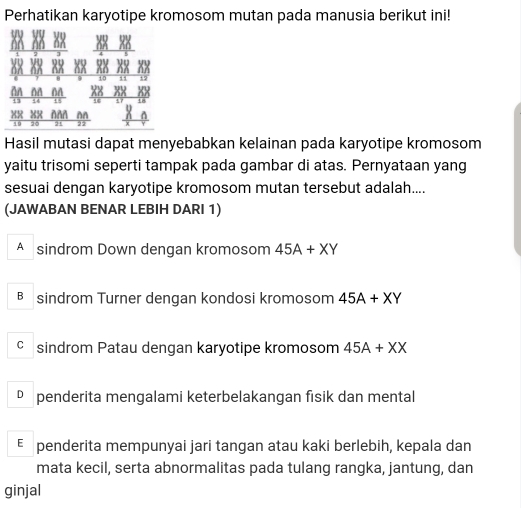 Perhatikan karyotipe kromosom mutan pada manusia berikut ini!
An
+8
8x
19 20 NAA ^n
21 22
Hasil mutasi dapat menyebabkan kelainan pada karyotipe kromosom
yaitu trisomi seperti tampak pada gambar di atas. Pernyataan yang
sesuai dengan karyotipe kromosom mutan tersebut adalah....
(JAWABAN BENAR LEBIH DARI 1)
A sindrom Down dengan kromosom 45A+XY
B sindrom Turner dengan kondosi kromosom 45A+XY
sindrom Patau dengan karyotipe kromosom 45A+XX
D penderita mengalami keterbelakangan fisik dan mental
penderita mempunyai jari tangan atau kaki berlebih, kepala dan
mata kecil, serta abnormalitas pada tulang rangka, jantung, dan
ginjal