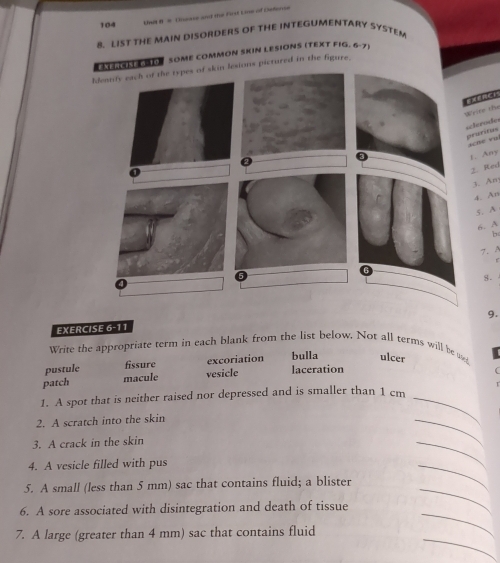 104 Med B i Cnease and the Fost Line of Cefene
2. LIST THE MAIN DISORDERS OF THE INTEGUMENTARY SYSTEM
HE SOME COMMON SKIN LESIONS (TEXT FIG. 6-7)
pictured in the figure,
ite the
lerode uritus
che rui
. Any
. Red
3. Am
4. An
5. A
6. A
b
7.A
8.
9.
EXERCISE 6-11
Write the appropriate term in each blank from the list below. Not all terms will be
pustule fissure excoriation bulla ulcer
patch macule vesicle laceration
1. A spot that is neither raised nor depressed and is smaller than 1 cm _
2. A scratch into the skin
3. A crack in the skin
_
4. A vesicle filled with pus
_
_
_
5. A small (less than 5 mm) sac that contains fluid; a blister
_
6. A sore associated with disintegration and death of tissue
_
7. A large (greater than 4 mm) sac that contains fluid