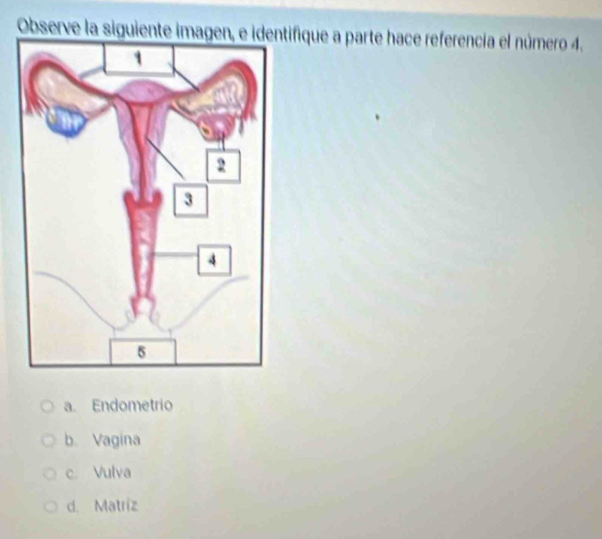 Observe la siguiente imagen, e identifique a parte hace referencia el número 4.
a. Endometrio
b. Vagina
c. Vulva
d. Matríz