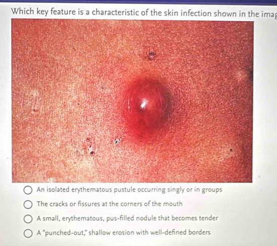 Solved: Which key feature is a characteristic of the skin infection ...