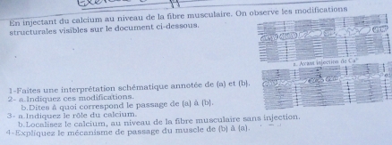 En injectant du calcium au niveau de la fibre musculaire. On observe les modifications 
structurales visibles sur le document ci-dessous. 
1-Faites une interprétation schématique annotée de (a) et (b) 
2- a.Indiquez ces modifications. 
b.Dites à quoi correspond le passage de (a) à (b). 
3- a Indiquez le rôle du calcium. 
b.Localisez le calcium, au niveau de la fibre musculaire sans injection. 
4-Explíquez le mécanisme de passage du muscle de (b) à (a).