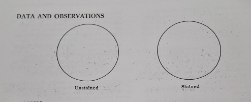 DATA AND OBSERVATIONS 
Unstained Stained