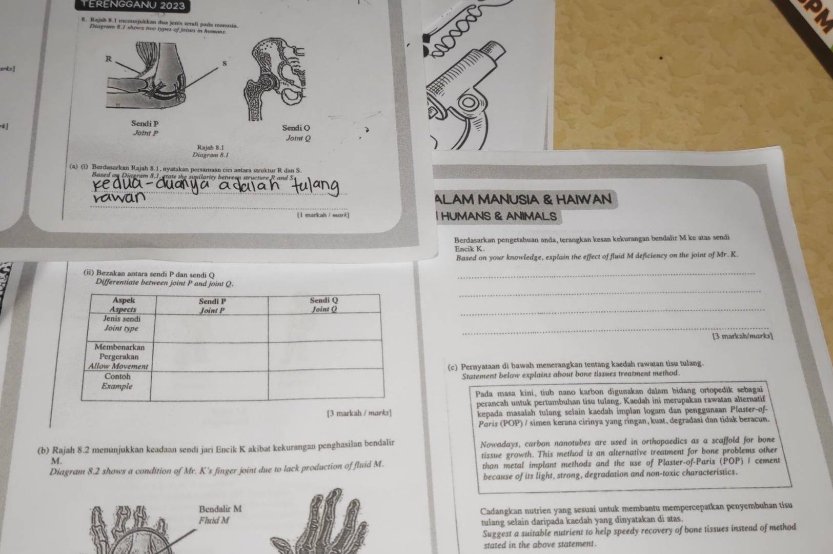 TERENGGANU 2023
8. Rajah 8.1 mcounjukkan dua jonis sendi pada manusia.
y
Diagram 8.1 shows two types of Joinix in humans 9
anks]
2
Rajah 8.1
Diagram 8.1
(a) (i) Berdasarkan Rajah 8.1, nyatakan persamaan ciri antara struktur R dan S.
Based on Diagram 8.1, state the similarity between structure R and S
_
_
ALAM MANUSIA & HAIWAN
[ I markah / mark] | HUMANS & ANIMALS
Berdasarkan pengetahuan anda, terangkan kesan kekurangan bendalir M ke atas sendi
Encik K
Based on your knowledge, explain the effect of fluid M deficiency on the joint of Mr. K.
(ii) Bezakan antara sendi P dan sendi Q
_
_
Differentiate between joint P and joint Q.
_
_
[3 markah/marks]
(c) Pernyataan di bawah menerangkan tentang kaedah rawatan tisu tulang.
Statement below explains about bone tissues treatment method.
Pada masa kini, tiub nano karbon digunakan dalam bidang ortopedik sebagai
perancah untuk pertumbuhan tisu tulang. Kaedah ini merupakan rawatan alternatif
[3 markah / marks] kepada masalah tulang selain kaedah implan logam dan penggunaan Plaster-of-
Poris (POP) / simen kerana cirinya yang ringan, kuat, degradasi dan tidak beracun.
(b) Rajah 8.2 menunjukkan keadaan sendi jari Encik K akibat kekurangan penghasilan bendalir Nowadays, carbon nanotubes are used in orthopaedics as a scaffold for bone
tissue growth. This method is an alternative treatment for bone problems other
M.
Diagram 8.2 shows a condition of Mr. K's finger joint due to lack production of fluid M. than metal implant methods and the use of Plaster-of-Paris (POP) / cement
because of its light, strong, degradation and non-toxic characteristics.
Bendalir M
Fluid M Cadangkan nutrien yang sesuai untuk membantu mempercepatkan penyembuhan tisu
tulang selain daripada kaedah yang dinyatakan di atas.
Suggest a suitable nutrient to help speedy recovery of bone tissues instead of method
stated in the above statement.