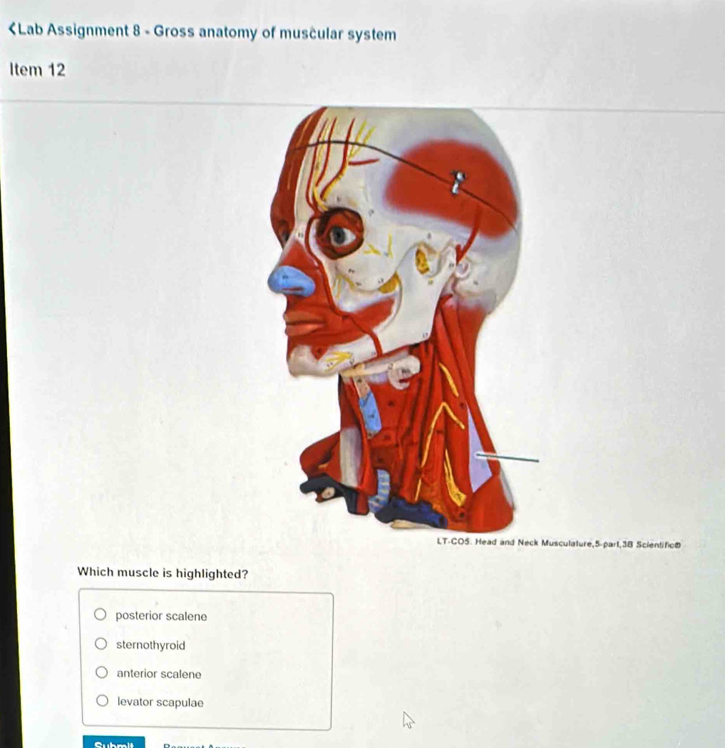 posterior scalene
sternothyroid
anterior scalene
levator scapulae