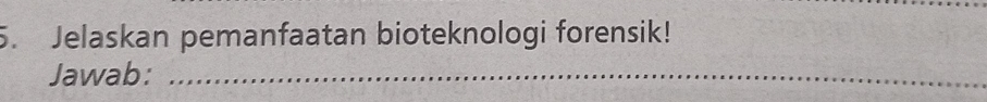 Jelaskan pemanfaatan bioteknologi forensik! 
Jawab:_