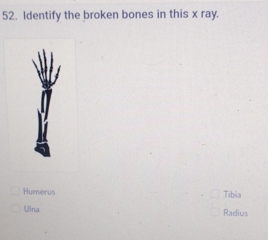 Identify the broken bones in this x ray.
Humerus Tibia
Ulna Radius