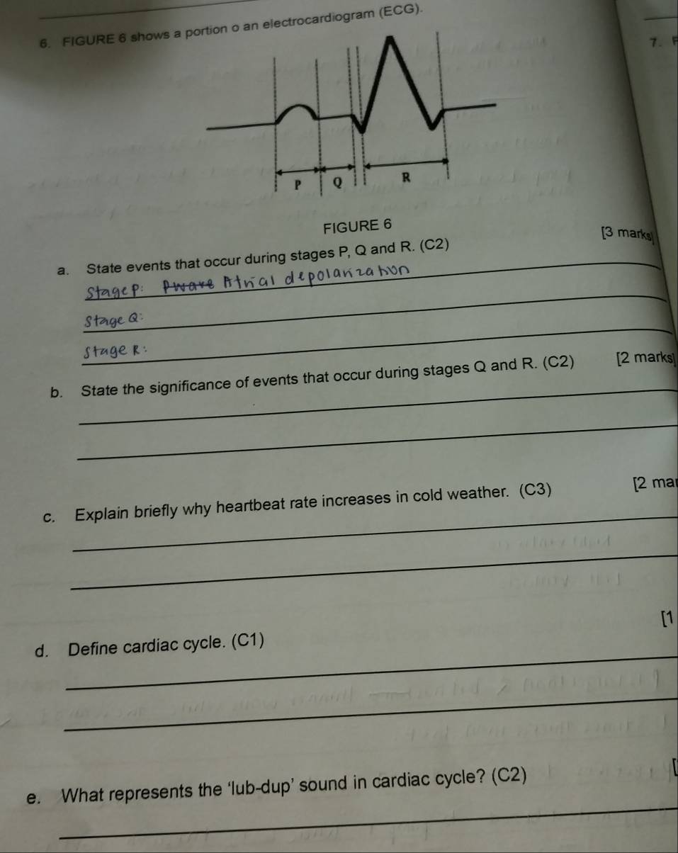 FIGURE 6 shows a portion o an electrocardiogram (ECG). 
7. F
P Q R
FIGURE 6 
[3 marks 
a. State events that occur during stages P, Q and R. (C2) 
_ 
_ 
to 
_ 
b. State the significance of events that occur during stages Q and R. (C2) [2 marks] 
_ 
_ 
c. Explain briefly why heartbeat rate increases in cold weather. (C3) [2 ma 
_ 
[1 
_ 
d. Define cardiac cycle. (C1) 
_ 
_ 
e. What represents the ‘lub-dup’ sound in cardiac cycle? (C2)