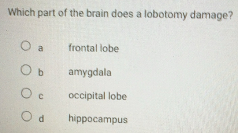 Solved: Which part of the brain does a lobotomy damage? a frontal lobe ...