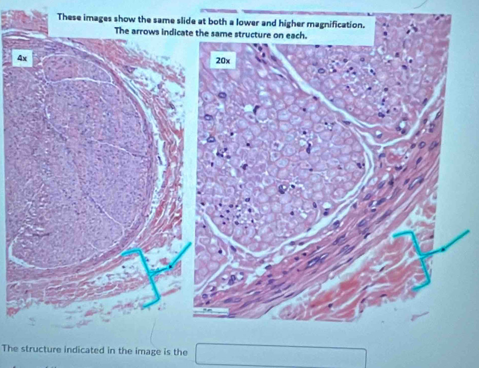 These images show the same sl 
The structure indicated in the image is the □